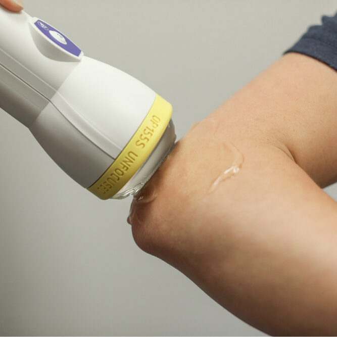 20230504-2N8A1441 SoftWave Elbow Treatment