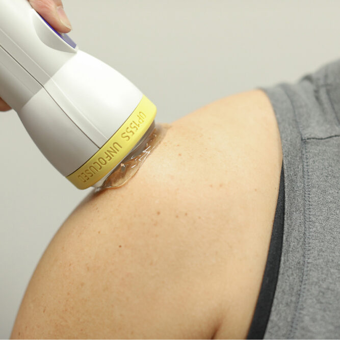 shoulder-treatment SoftWave shoulder treatment